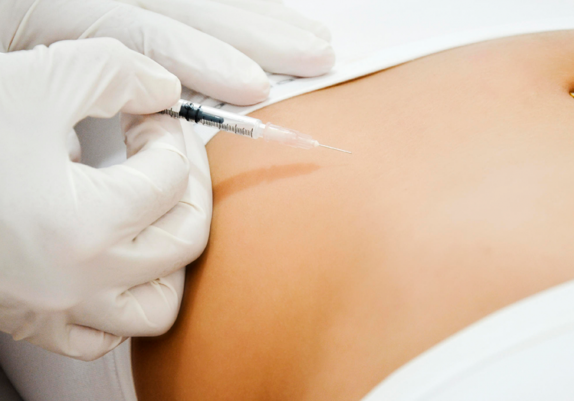 TRATAMENTO PARA ESTRIAS, CELULITE E GORDURA LOCALIZADA