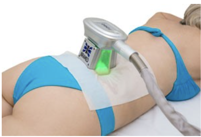 A NOVA CRIOLIPÓLISE